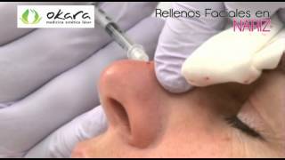 RELLENOS FACIALES  Okara Medicina Estética Láser [upl. by Ahsemrak743]