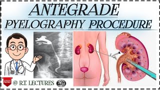 Antegrade pyelogram Antegrade pyelography procedure Alternate of IVP procedure in hindienglish [upl. by Enoj]