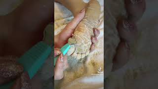 Full foot callus removal  Epidermolytic Palmoplantar Keratoderma  Jan 30 2023 [upl. by Marden]