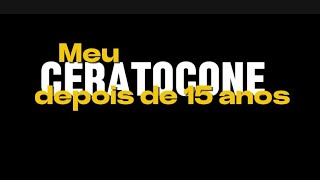 Como está meu Ceratocone depois de 15 anos Lentes de contato e Hidropsia [upl. by Enoyrt]