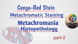 CongoRed Stain For Amyloid ll Metachromatic staining ll Histology [upl. by Itsyrk]