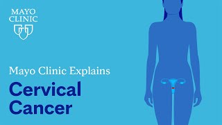 Mayo Clinic Explains Cervical Cancer [upl. by Noelopan]