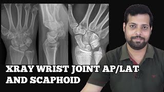 HOW TO DO WRIST JOINT AP LAT SCAPHOID SERIES xrayclasses WRISTJOINT xraytechnician [upl. by Bev375]