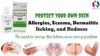 Betaderm Lotion uses benefits and side effects in UrduHindi [upl. by Reinaldos523]