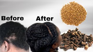 how to use CLOVES and FENUGREEK FOR HAIR GROWTH [upl. by Massie]