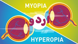 Difference between Myopia amp Hyperopia  Myopia Aur Hyperopia Main Farak  UrduHindi [upl. by Strader]