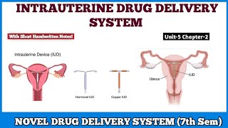 Intrauterine Drug Delivery System IUD  IUDs  Novel Drug Delivery System 7th semester [upl. by Teilo]