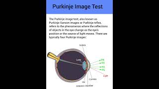 Purkinje image test or purkinje light reflex test in ophthalmology Optometry Fans [upl. by Schnabel]