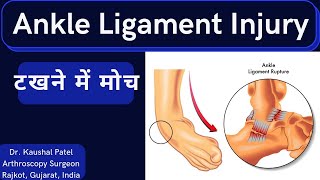 Ankle Ligament injury  Diagnosis and Management anklesprain anklepain [upl. by Boehike]