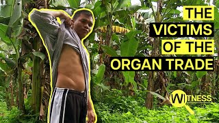 Organ Thieves Inside the Dark World of Organ Trafficking  Organ Trade Documentary [upl. by Paucker]