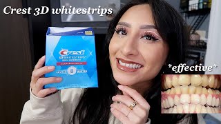 I tried the crest 3D whitestrips for 14 days effective 2023 [upl. by Ursel]