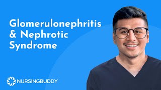 NURSING REVIEW  Glomerulonephritis amp Nephrotic Syndrome [upl. by Clara]