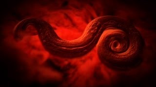 Rat Lung Worm Disease  Monsters Inside Me Ep8 [upl. by Aynek]