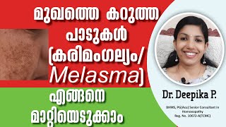 കരിമംഗല്യം വീട്ടിൽ തന്നെ മാറ്റാൻ എളുപ്പവഴി മുഖത്തെ കറുത്തപാടുകൾ മാറാൻ Karimangalyam  pigmentation [upl. by Killion70]