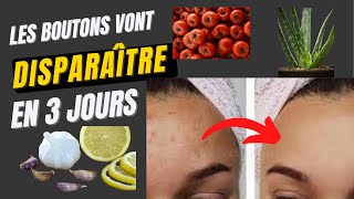 Comment éliminer les boutons du visage rapidement en 3 jours ≠4Astuces très efficaces [upl. by Anastos]