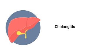 Entzündung der Gallengänge Cholangitis  Erkrankungen von Leber Gallenwege und Pankreas [upl. by Elletsyrk]