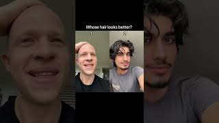 WHOSE HAIR LOOKS 🔥 hair hairstyle funny youtubeshorts shorts bald [upl. by Ihcehcu]