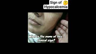 Hypocalcemia mbbs neetpg [upl. by Adyan]