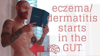 Eczema  Dermatitis starts in the GUT and Digestion how to heal all of them [upl. by Schoenberg]