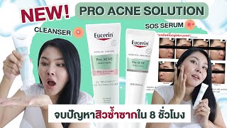 กูรูเช็ค EUCERIN SOS SERUM และ 3X Treatment Gel to Foam Cleanser จบทุกสิวซ้ำซาก ใน 8 ชม [upl. by Chon]