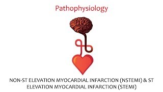 Myocardial Infarction  STEMI and NSTEMI [upl. by Assilem]