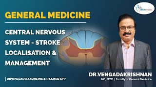 General Medicine  Central Nervous System  Stroke Localisation and Management  Raaonline [upl. by Meghan]