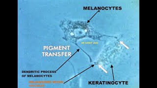 Pigment transfer in Skin cells Melanosome transfer from MELANOCYTE to KERATINOCYTE I Dr Somit Jain [upl. by Haret332]