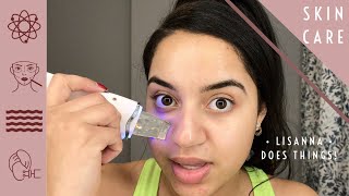 HOW TO USE AN ULTRASONIC SPATULA TO EXTRACT MOISTURIZE AND LIFT SKIN AT HOME amp REVIEW [upl. by Mateo932]