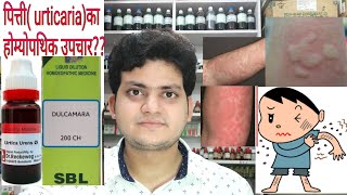 Urticaria Homeopathic medicine for Urticaria explain [upl. by Ocirederf]