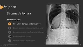 Radiografía de Abdomen Paso a Paso [upl. by Anitserp]