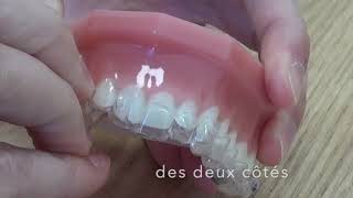 Comment mettre et retirer ses aligners Invisalign [upl. by Atsyrc]