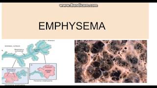 Emphysema Types Pathogenesis and morphology [upl. by Gaddi798]