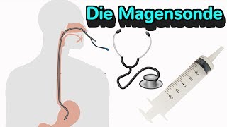 Alles wissenswerte zur Magensonde [upl. by Gwenore794]