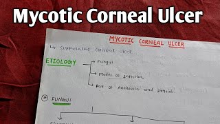 MYCOTIC CORNEAL ULCER  A K KHURANA  OPHTHAL [upl. by Acirehs]