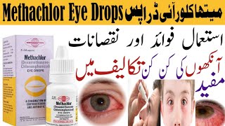 Methachlor Eye Drops PriceUsesBenefitsSide Effects Redness of Eye Swelling in eye [upl. by Betty]