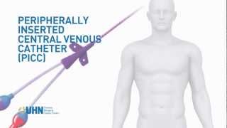 Learn About the Peripherally Inserted Central Venous Catheter PICC [upl. by Ninazan]