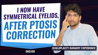 The Best treatment Options for Droopy Eyelids Ptosis  Patient experience  Ptosis treatment [upl. by Adihahs]