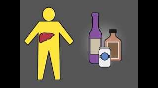 Pentoxifylline or Prednisolone [upl. by Custer]