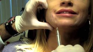 Cannula Method for Fillers  Dr Nissan Pilest Irvine CA [upl. by Odessa]