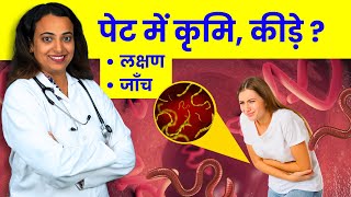 Pet me Kide Krimi Hone Ke Lakshan  Symptoms Worm Infection in Stomach [upl. by Dorotea]