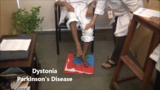 Understanding Dystonia Symptoms in Parkinsons Disease  Dr Paresh Doshi [upl. by Ellga12]