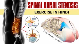 Spinal canal stenosis exercises in hindi  6 best lumbar canal stenosis exercises in hindi [upl. by Malsi]