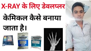 xray ke liye developer kaise banaya jata hai  how to make developer and fixer for xray in hindi [upl. by Baggs389]