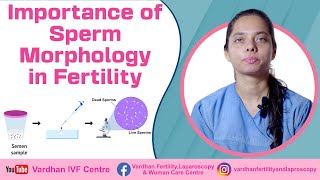 Importance of Sperm Morphology in Fertility  What is Sperm Morphology Understanding the Basics [upl. by Noelopan]