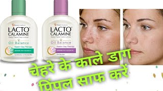 LACTO CALAMINE REVIEWLACTO CALMINE USESBest water based moisturizer for oily skin [upl. by Yras]