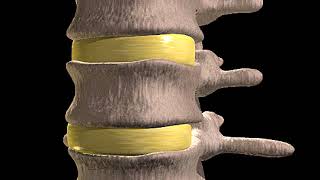 How Slipped Discs Happen Animation What’s Herniation  Herniated Nucleus Pulposus Bulging Disc Video [upl. by Giulia]