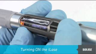 BIOLASE iLase Diode Laser Setup and Operation [upl. by Adriene]