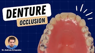 Occlusion for Complete Dentures  PDP162 [upl. by Si]