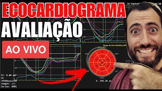 ECOCARDIOGRAMA eco cardiograma ecocardiograma com doppler ecocardiograma transtorácico [upl. by Einegue132]