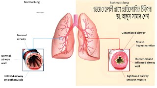 homoeohospital lerningforeveryoneএজমা [upl. by Aden]